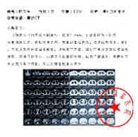 陽痿患者